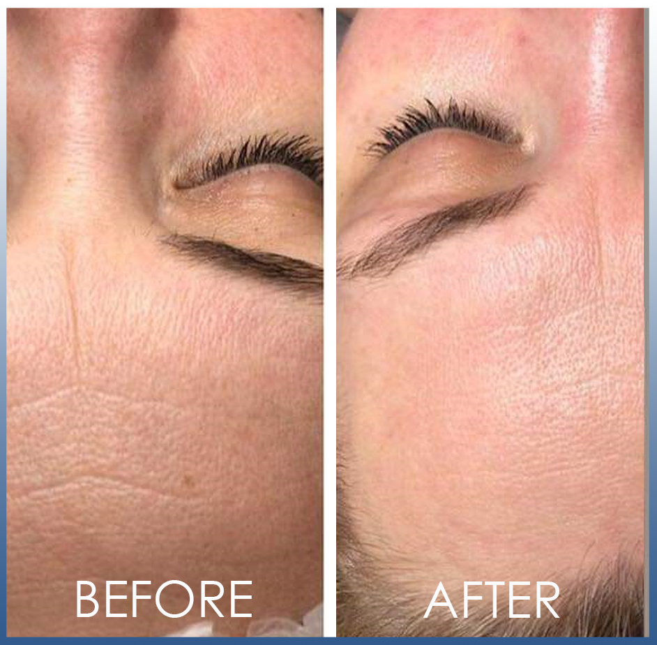 beforeafter13