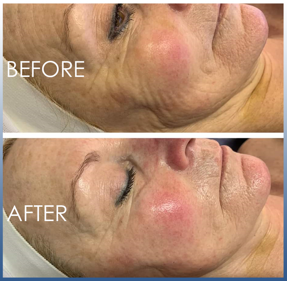 beforeafter4