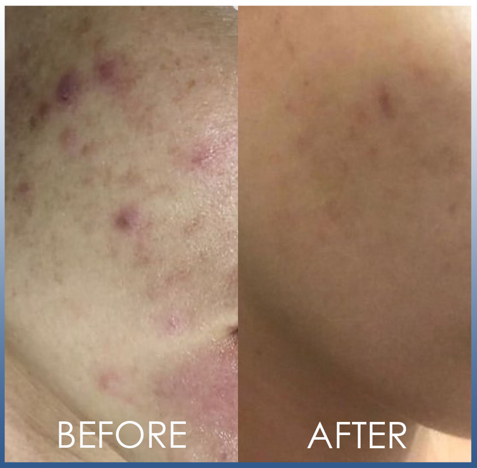 beforeafter5