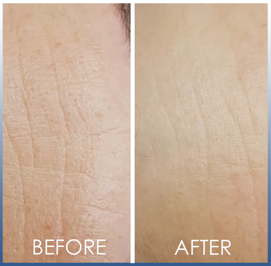 beforeafter7