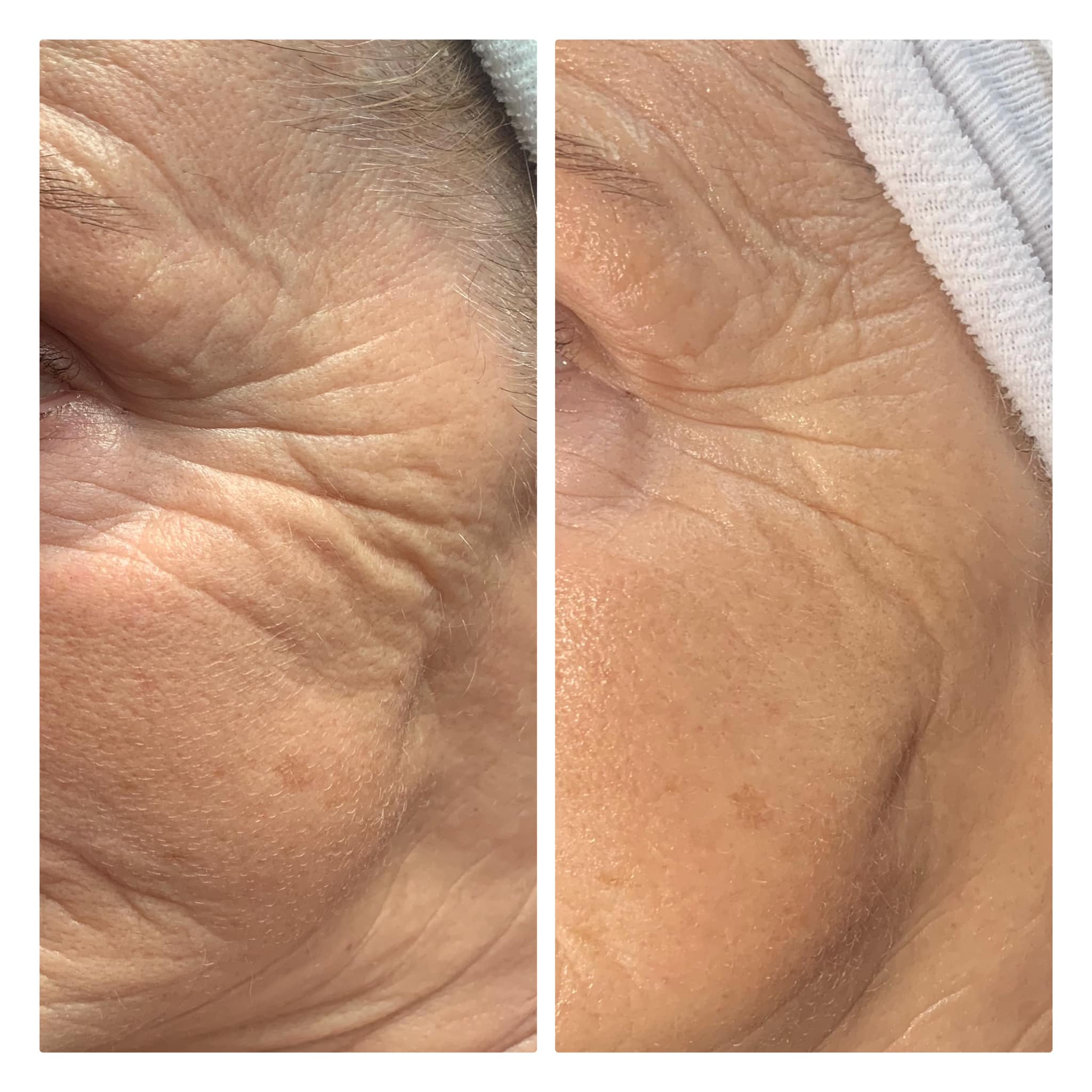 beforeandafter